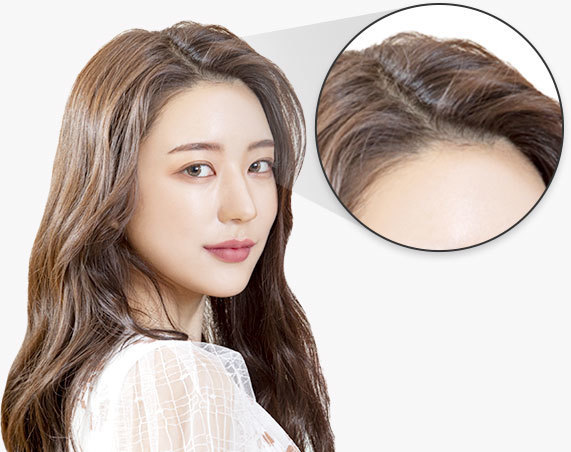 헤어라인 모델