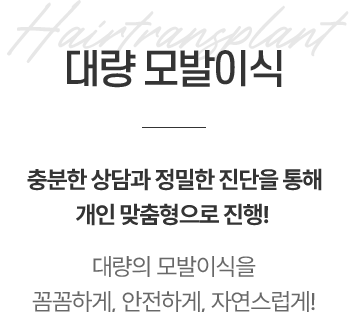 대량 모발이식