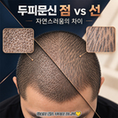 두피문신 점 vs 선, 자연스러움을 원한다면 점 방식이 나은 이유
