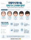 모발이식재수술, 밀도가 부족할 때 언제 다시 고려해야 할까?