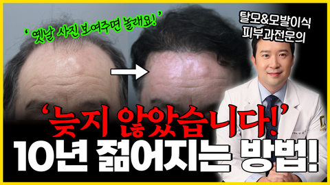 60대 모발이식 지금 시작해도 늦지 않았습니다!