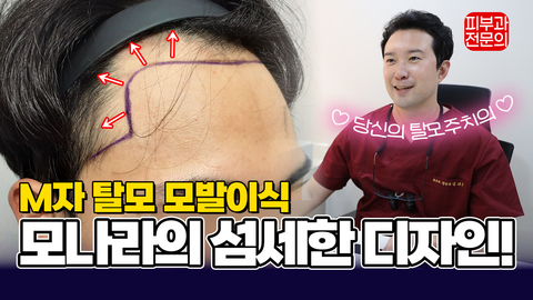 M자 탈모 모발이식 디자인 포인트는!? 한 끗 차이로 인상이 달라집니다!